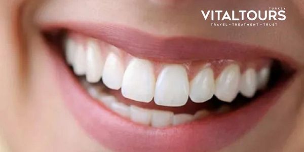 Vitaltours- Türkeireisen & Behandlungen zu erschwinglichen Preisen