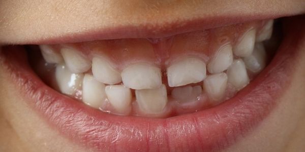 ARAG - Nach einem Zahnunfall immer zum Zahnarzt gehen