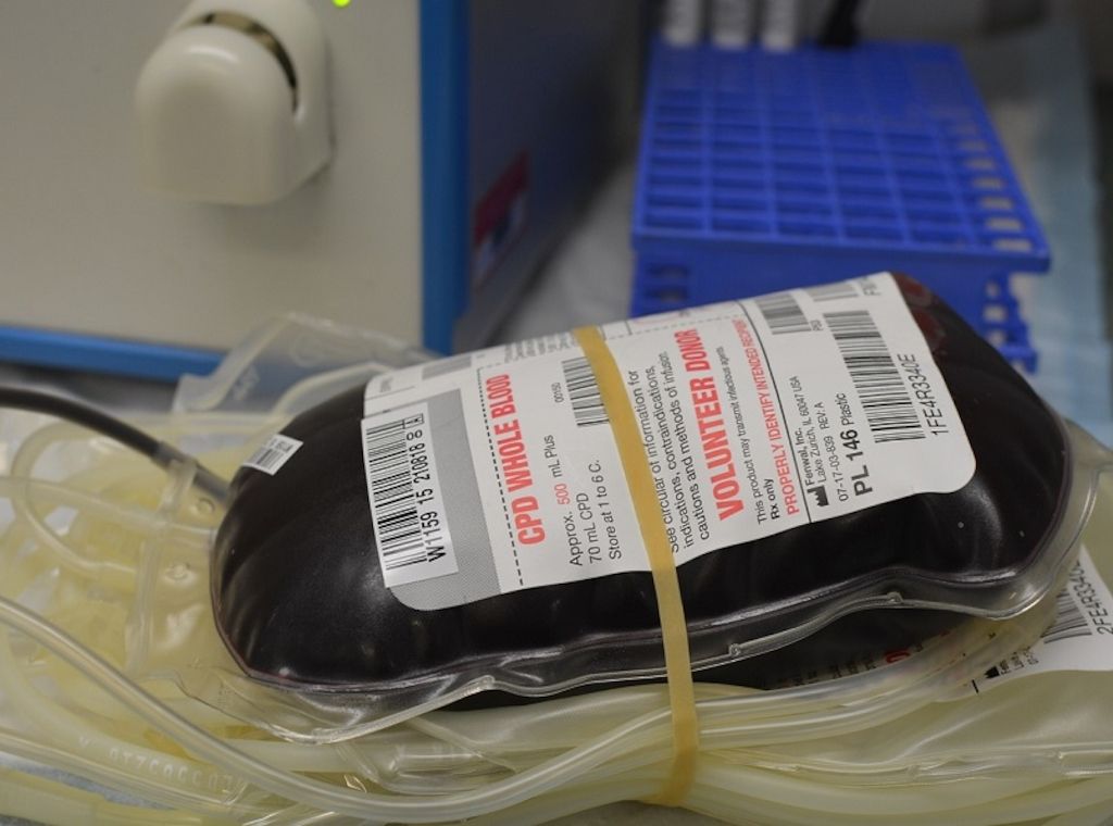 ARAG: Sexuelle Orientierung von Blutspendern darf keine Rolle mehr spielen 