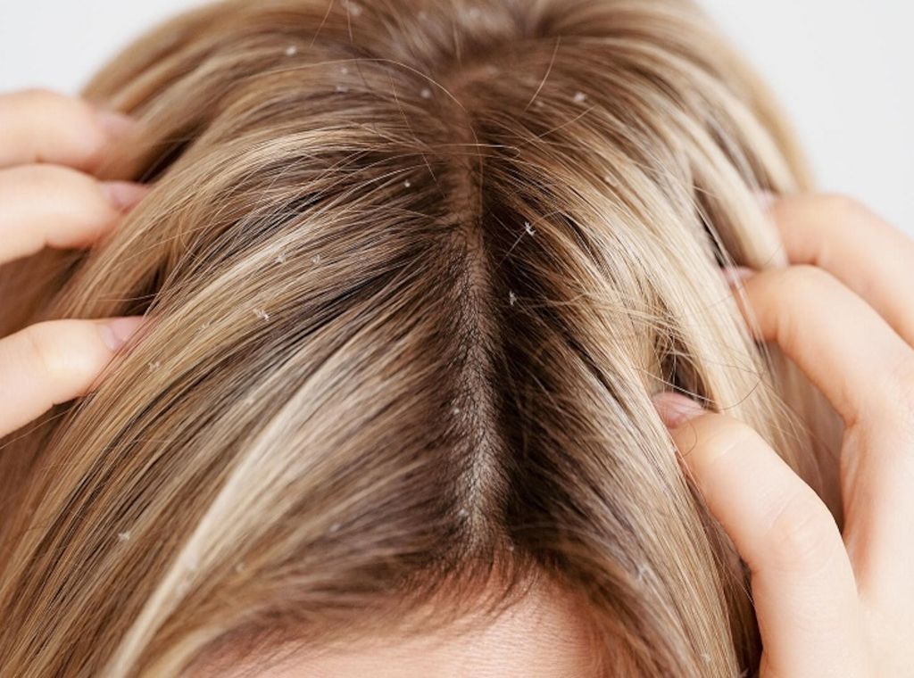 Myrto Naturkosmetik – Juckende Kopfhaut ins Gleichgewicht bringen