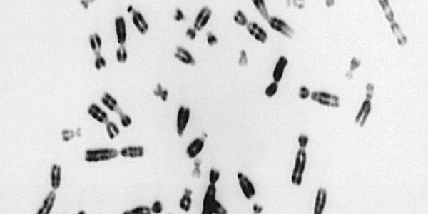 Charité-Studie- Wie Zellen mit zu vielen Chromosomen umgehen