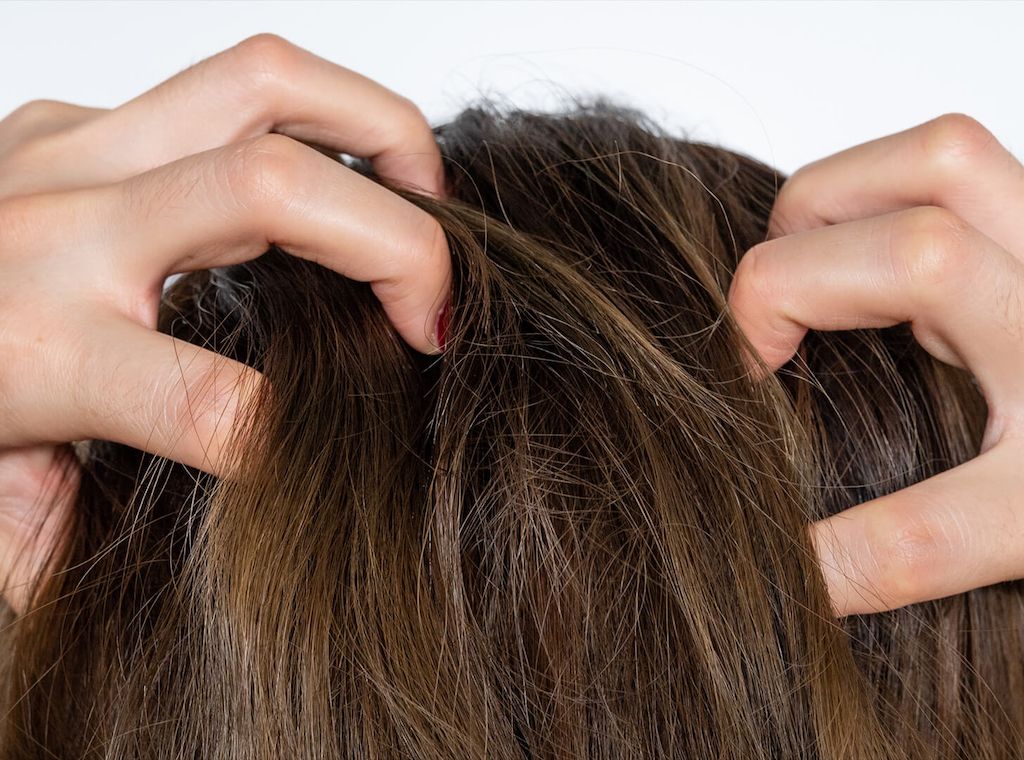 Myrto Naturkosmetik - Hautreizende Shampoos - ein weit verbreitetes Problem