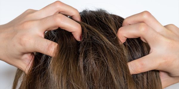 Myrto Naturkosmetik - Hautreizende Shampoos - ein weit verbreitetes Problem