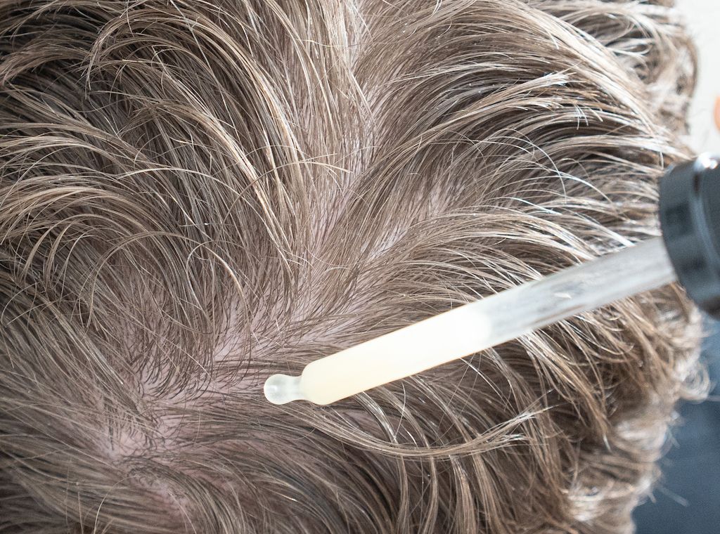 Myrto Naturkosmetik – Haarausfall: vorbeugen und behandeln
