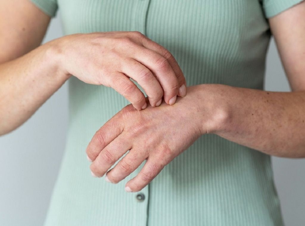 myrto Naturkosmetik - Psoriasis bzw. Schuppenflechte verstehen und lindern