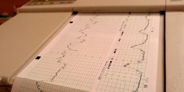 Frauenrat drängt auf besseren Schutz von ungewollt Schwangeren