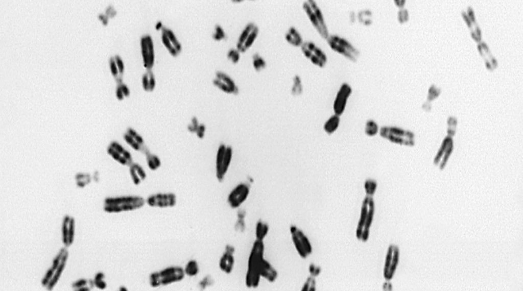 Charité-Studie- Wie Zellen mit zu vielen Chromosomen umgehen