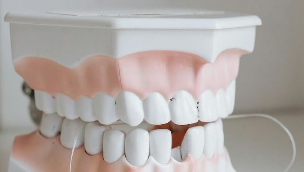 Wie schädlich ist Fluorid wirklich?