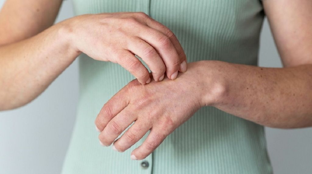 myrto Naturkosmetik - Psoriasis bzw. Schuppenflechte verstehen und lindern