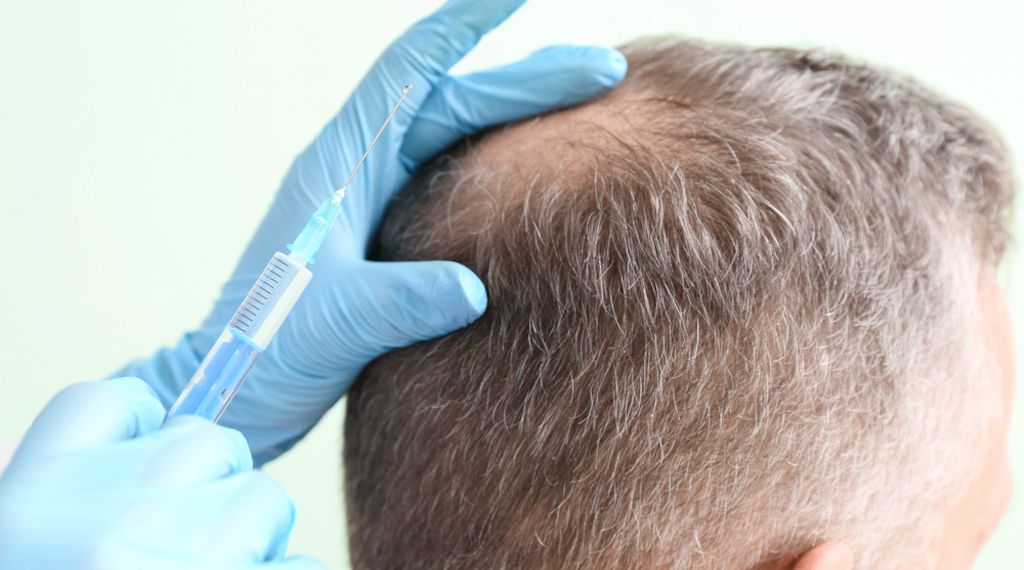 Neues Männerhaar statt Ausfall: Regenerative Therapie aktiviert Wachstum