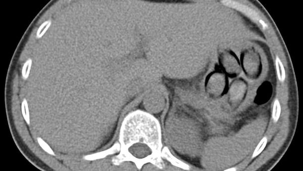 Kölner Zoll stellt Niederländer mit Kokain im Körper