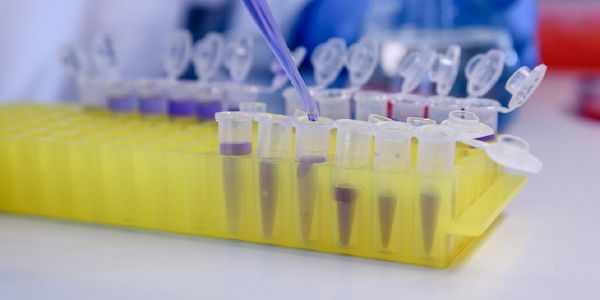 Studienhintergrund: So erreichen Lipödem-Patientinnen mehr Lebensqualität