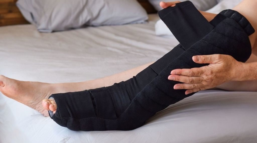 Worin unterscheiden sich die Erkrankungen Lipödem, Lymphödem und Lipolymphödem?