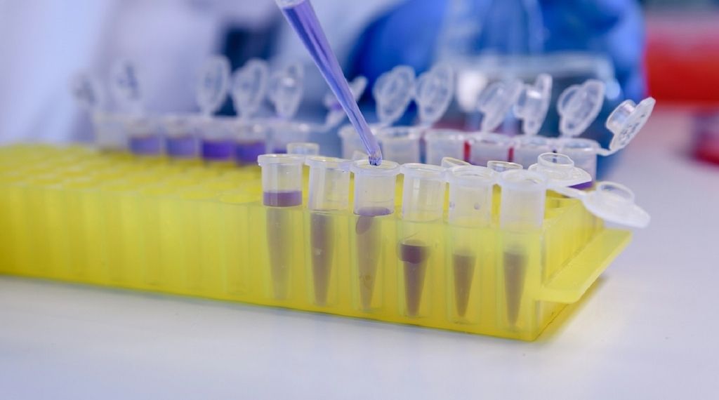 Studienhintergrund: So erreichen Lipödem-Patientinnen mehr Lebensqualität