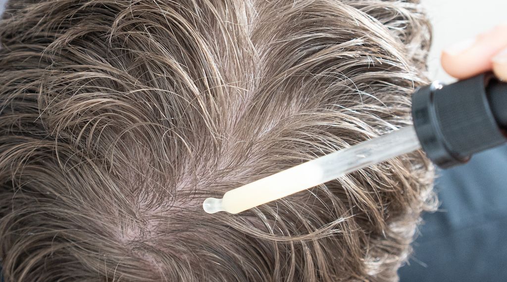 Myrto Naturkosmetik – Haarausfall: vorbeugen und behandeln