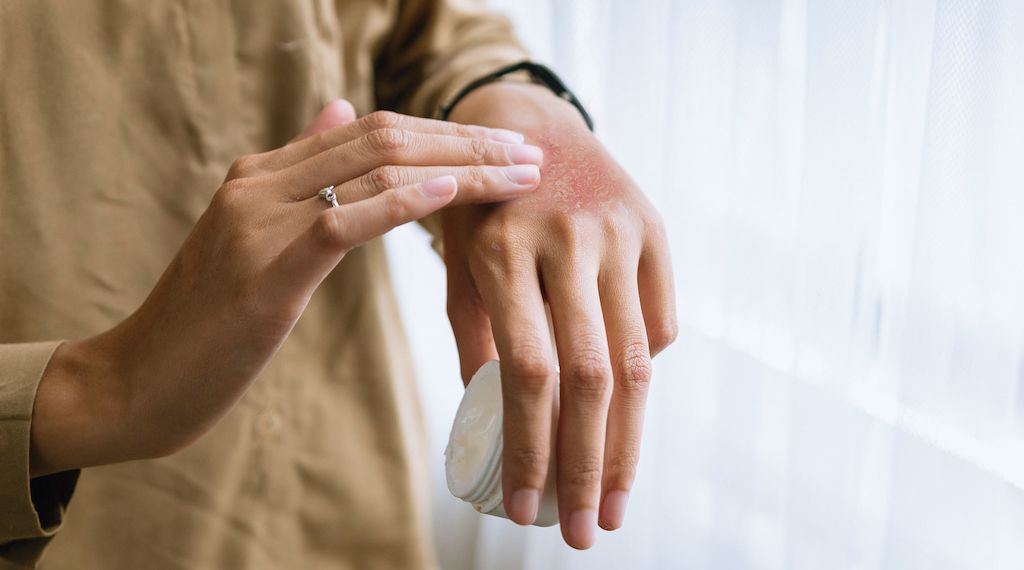 myrto Naturkosmetik - Effektive Hautpflege bei Neurodermitis