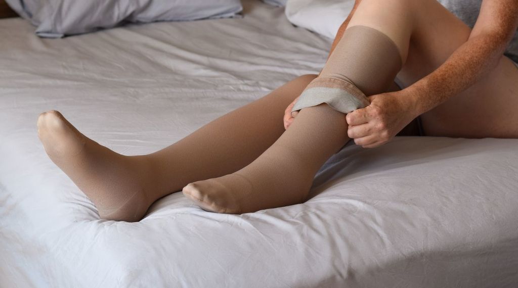 Wie effektiv ist Kompressionskleidung bei der Behandlung von Lipödem?