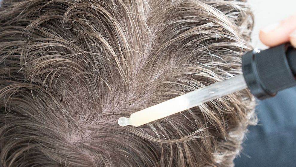 Haarausfall vorbeugen und behandeln