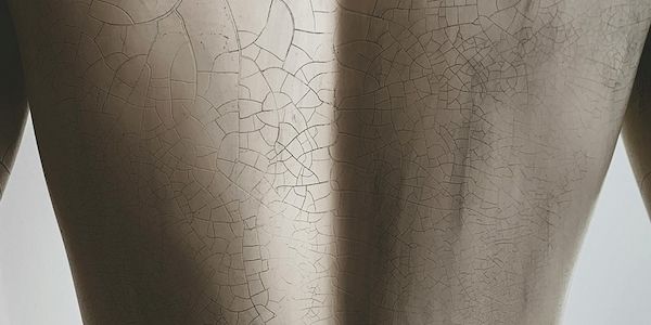 Starker Rücken: Was muss der Arbeitgeber tun?