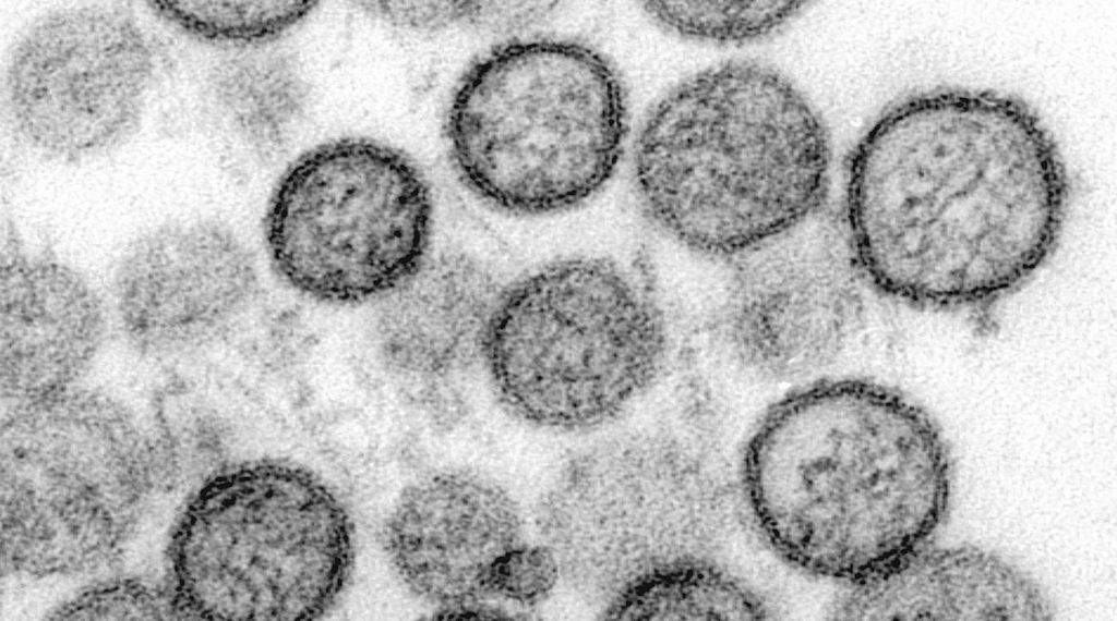 WHO: Hantavirus auf Schiff wurde von Mensch zu Mensch übertragen