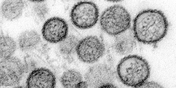 WHO: Hantavirus auf Schiff wurde von Mensch zu Mensch übertragen