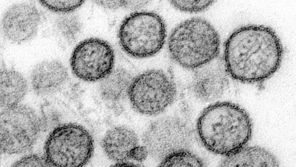 WHO: Hantavirus auf Schiff wurde von Mensch zu Mensch übertragen